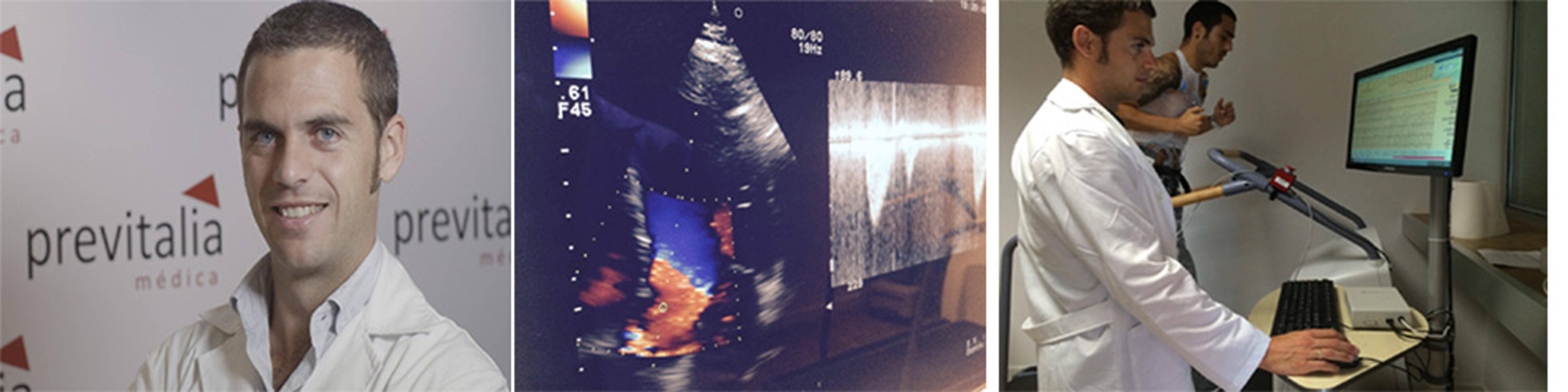 ecocardiografia aviles